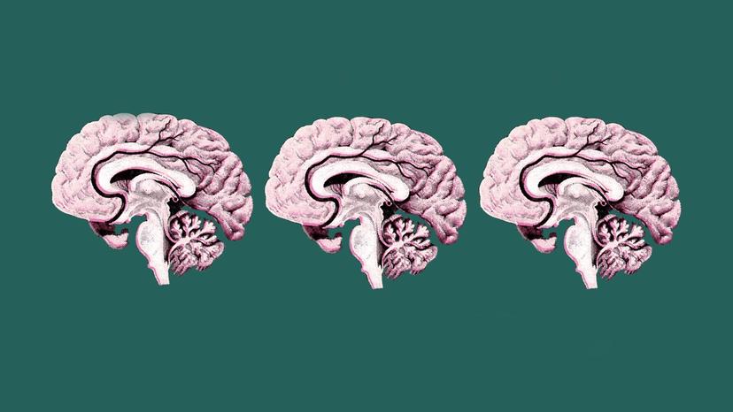 Sections through a brain.