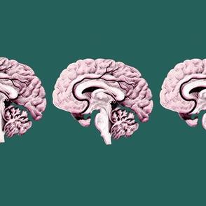 Sections through a brain.