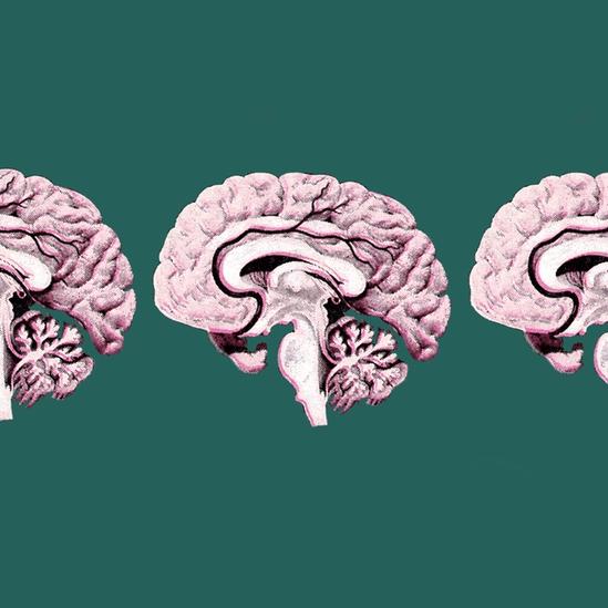 Sections through a brain.