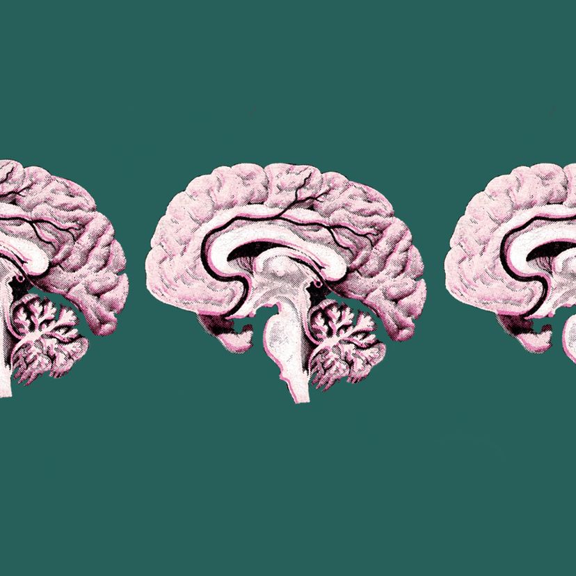 Sections through a brain.