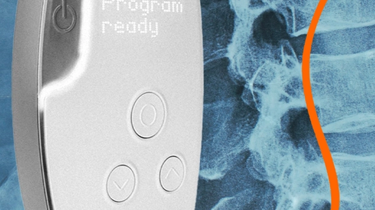 Onward Medical's ARC-EX system.