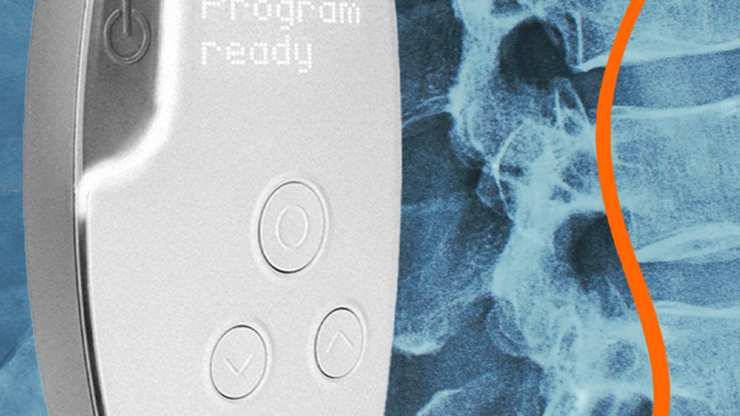 Onward Medical's ARC-EX system.
