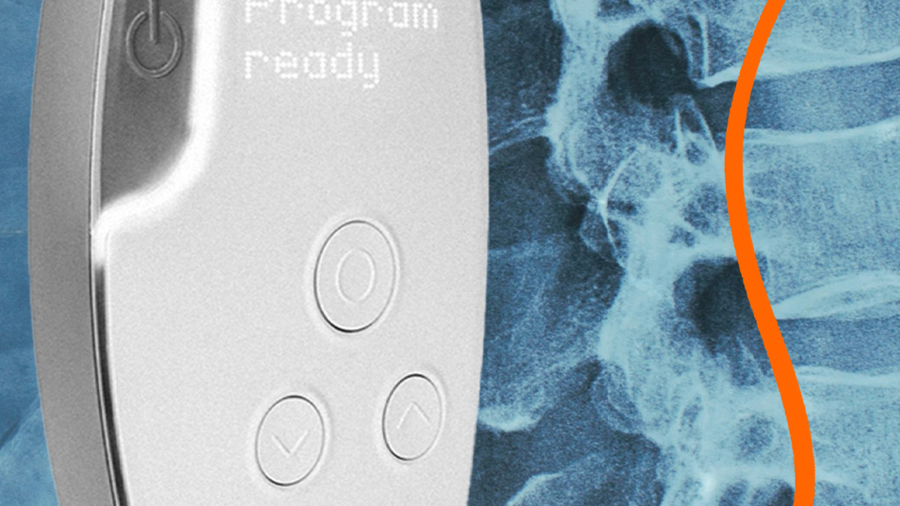 Onward Medical's ARC-EX system.