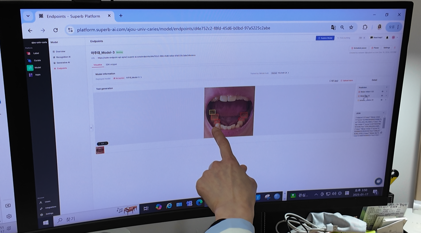 (Superb Platform上でのリアルタイム虫歯診断モデルのイメージ)