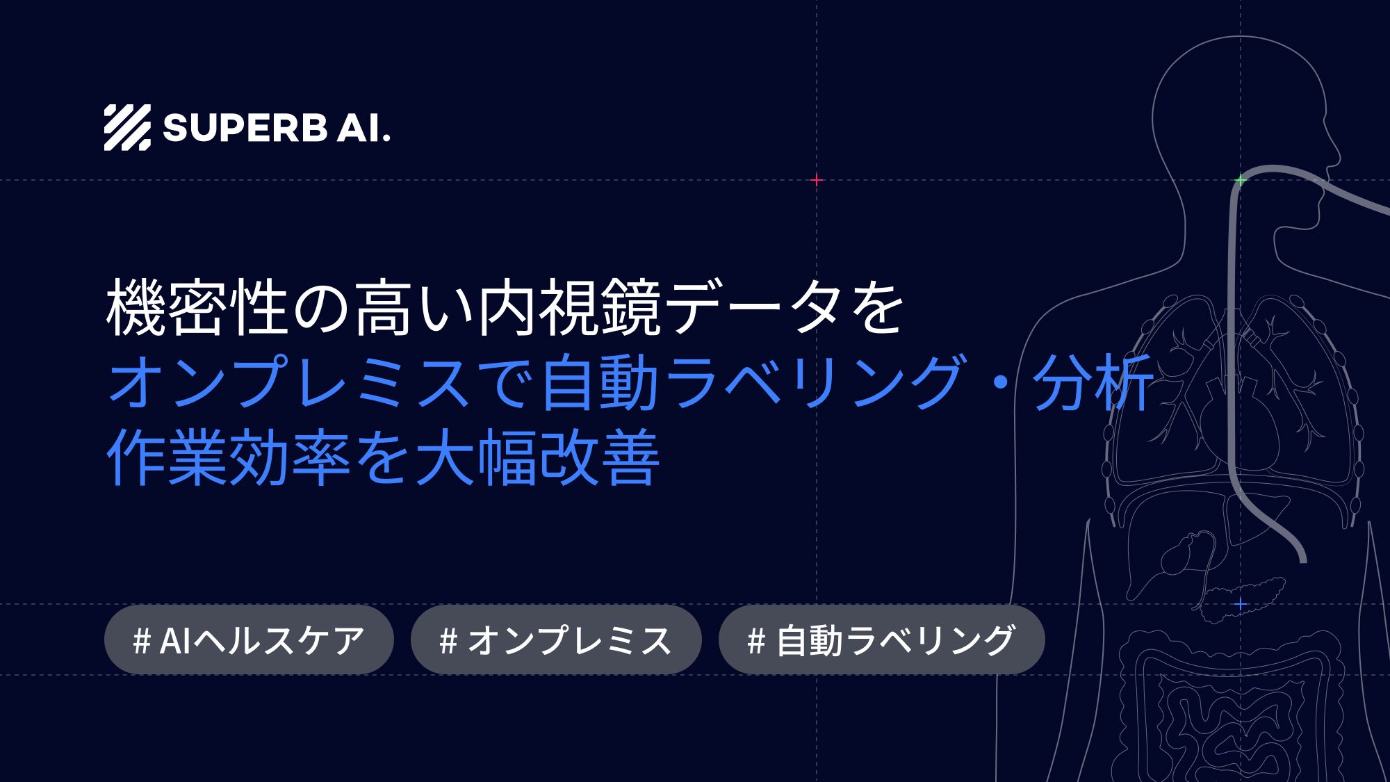 【導入事例】AIを活用した内視鏡腫瘍分析:ある主要ながん研究機関における成功事例