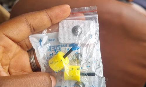 Why Early Intervention Cannot Be Overemphasized: M’s Story