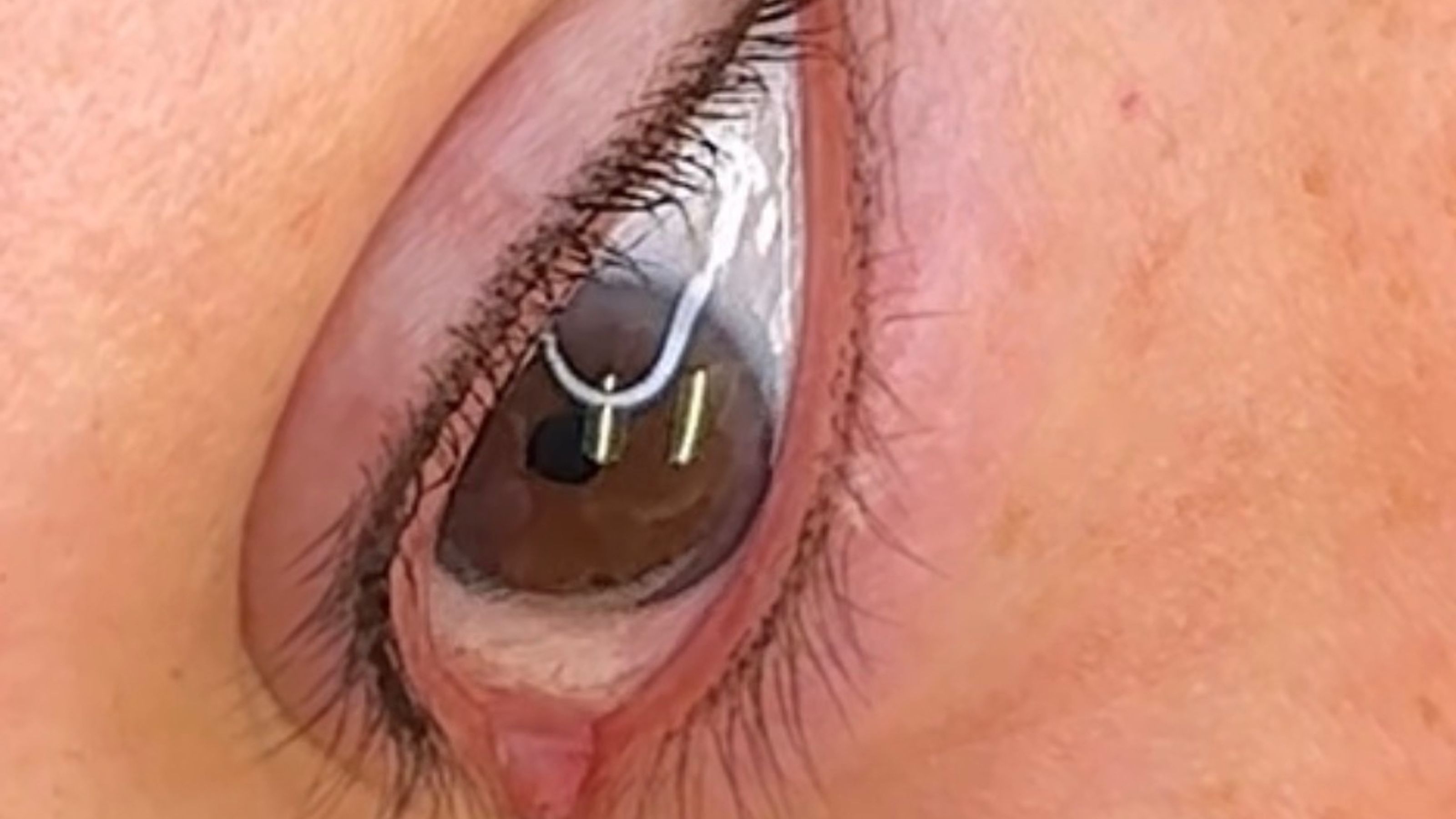 Permanent Eyeliner