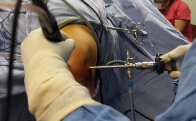 Cirugía artroscopica de rodilla 
