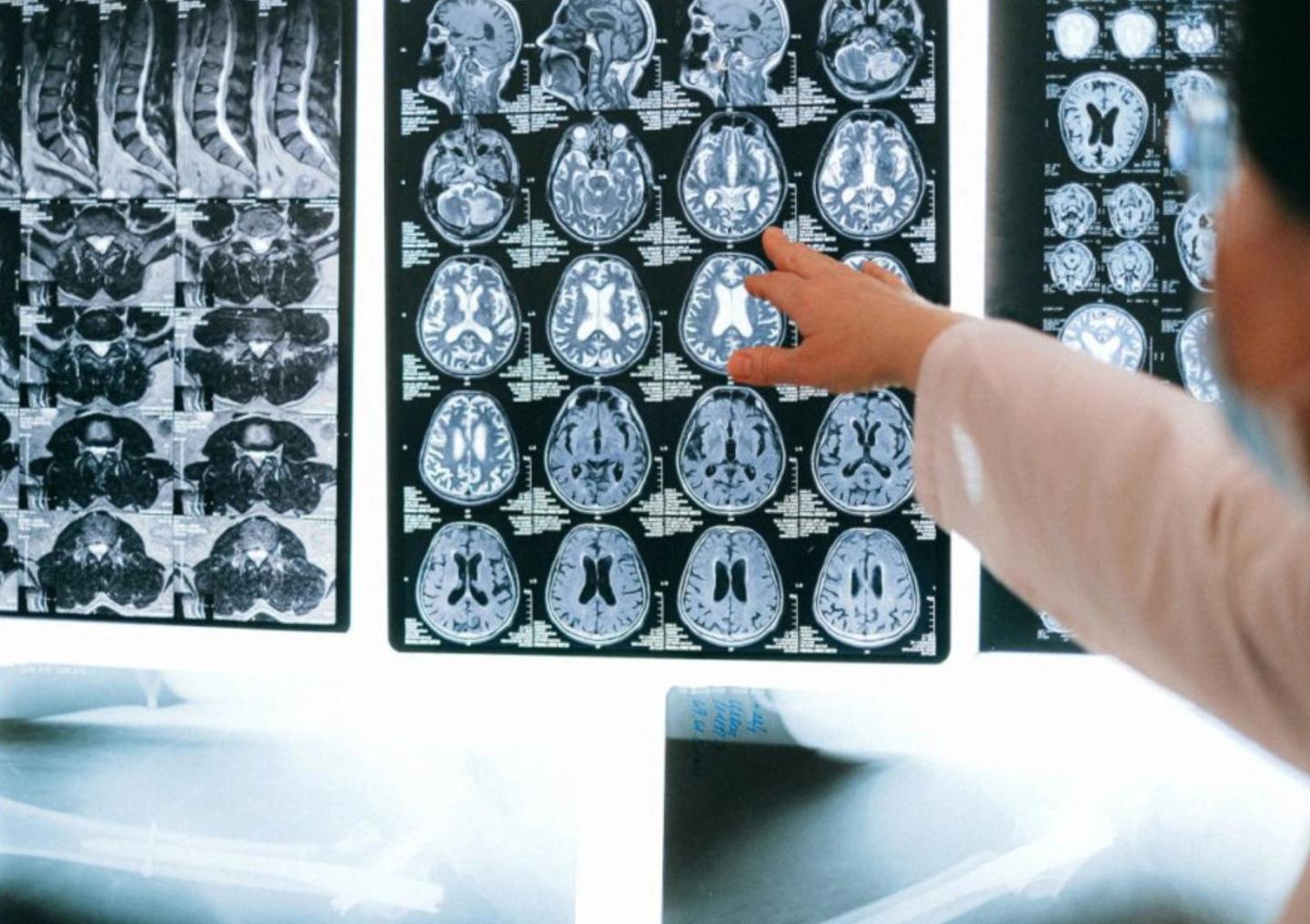 Umgang mit Patientendaten: Klage gegen Google-Tochter DeepMind