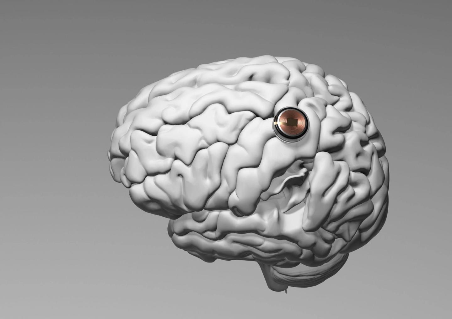 Musks Start-up Neuralink erhält grünes Licht für Gehirn-Computerchip-Tests an Menschen