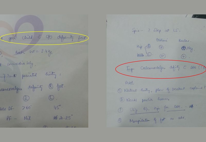 1 day old child came with complaint of foot deformity. But when Dr Somesh Virmani examined her patiently, she was also found to have dislocation of both hips.
