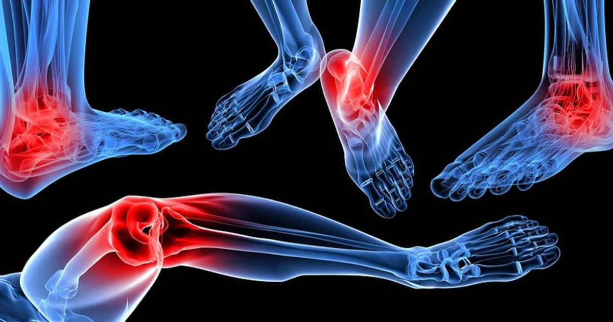 Illustration of foot, ankle and knee joints highlighted with pain
