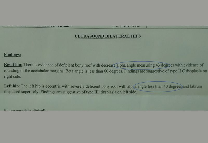 Ultrasound report of Hips