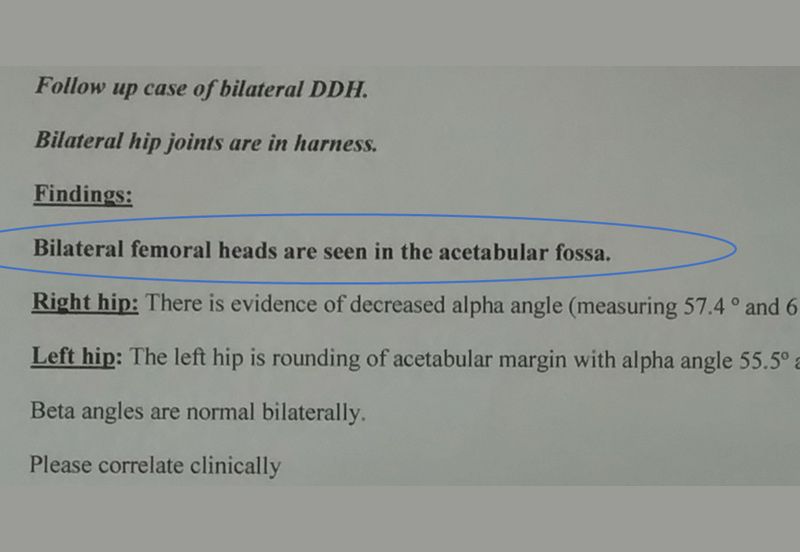 This is follow up Ultrasound report which clearly showed that hip has been put to its natural place.