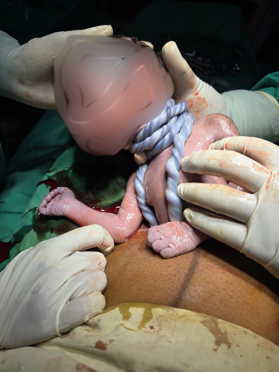 Baby Cord