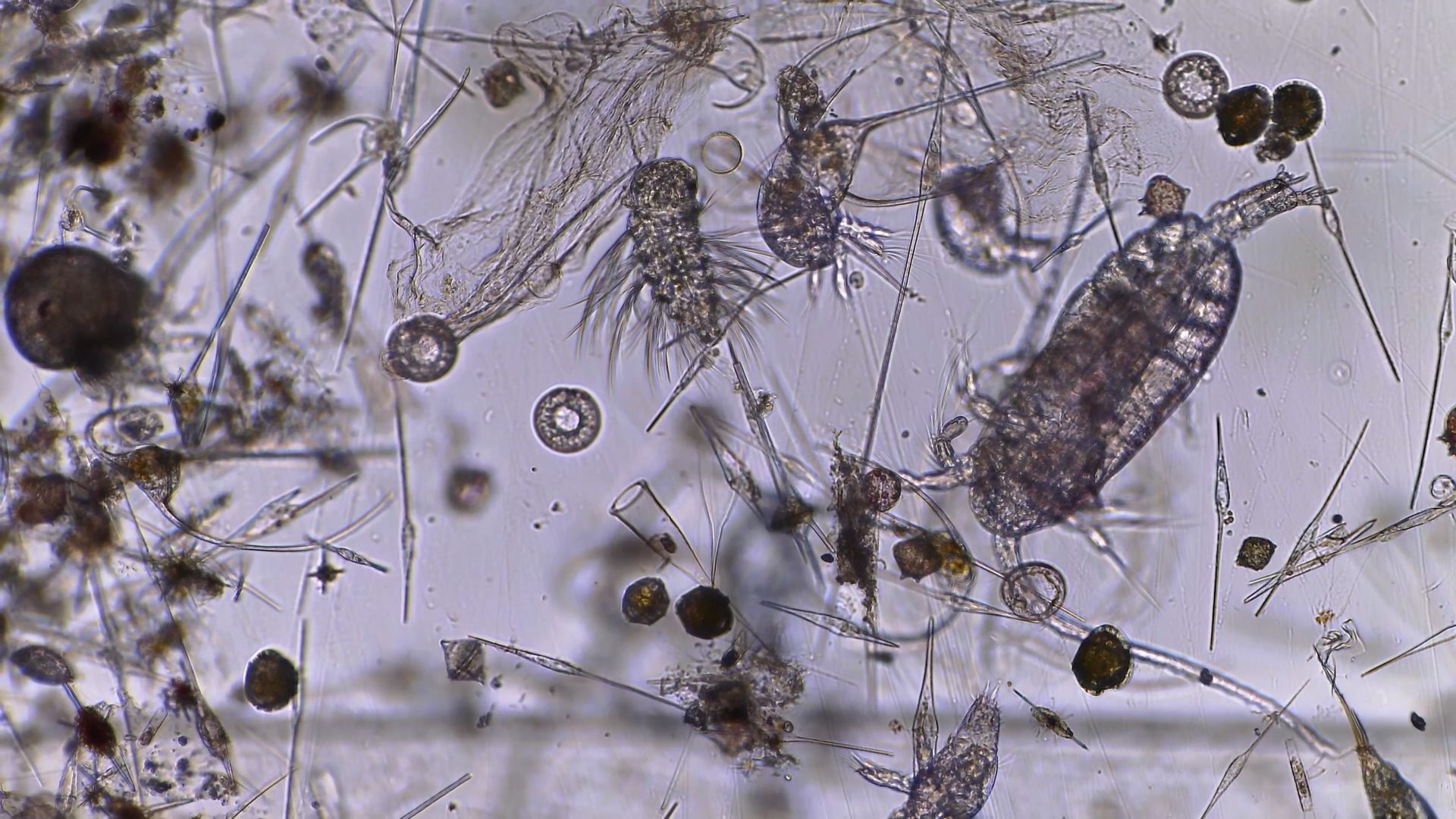 The sample is full of tiny organisms. Photo: Matteo Baratella