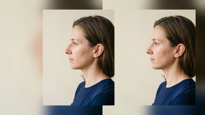 side-by-side profile portraits showing a subtle AI nose reshaping concept