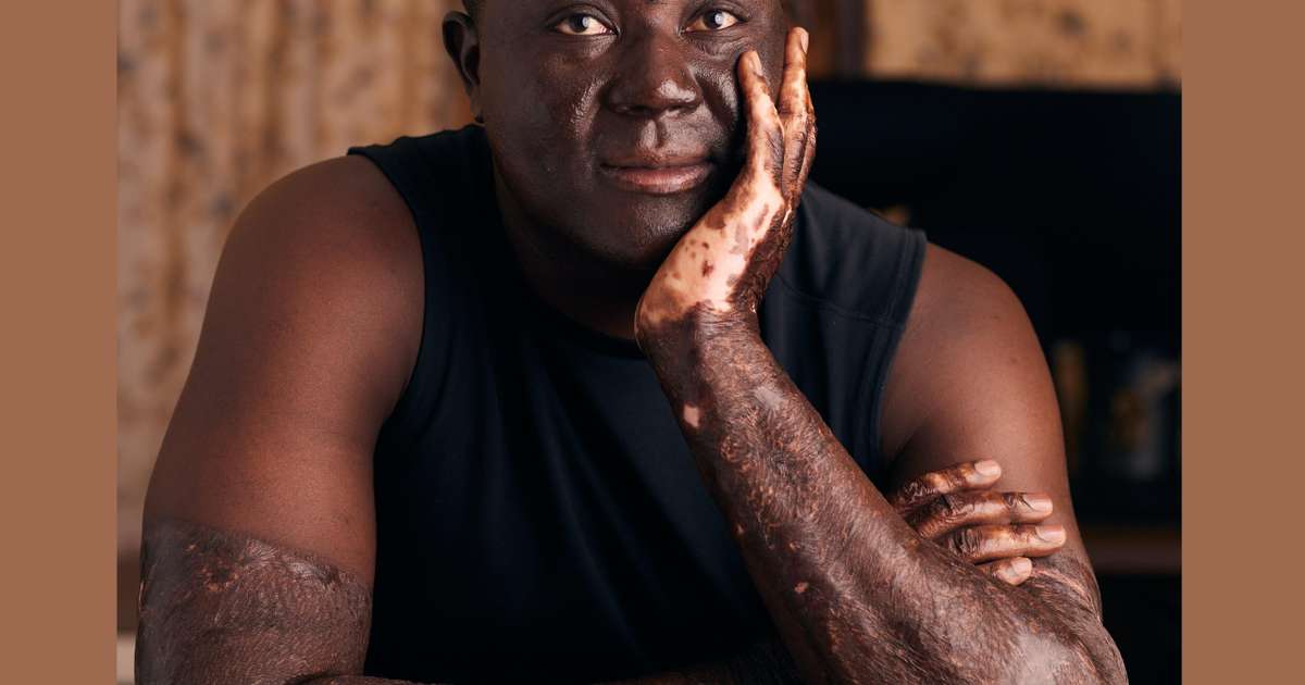 Pierre Kuma