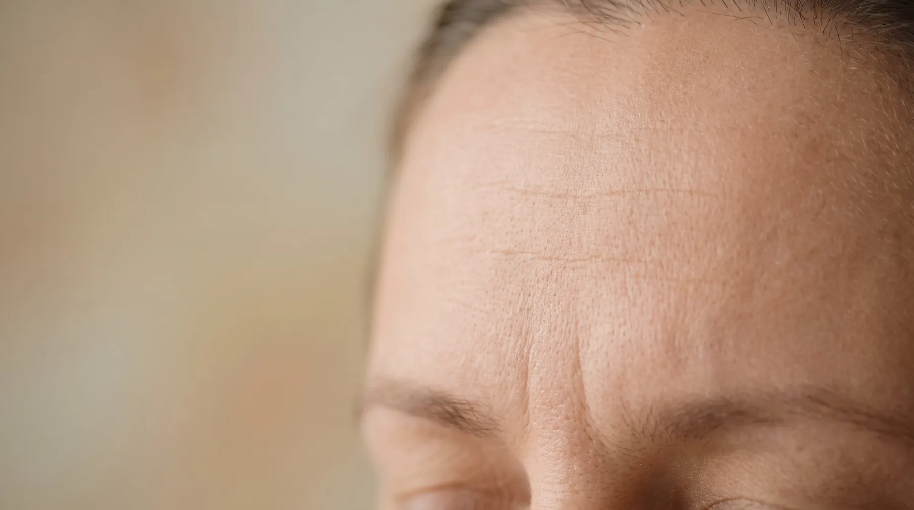 Forehead and brow lines, close up — PROVEN personalized skincare