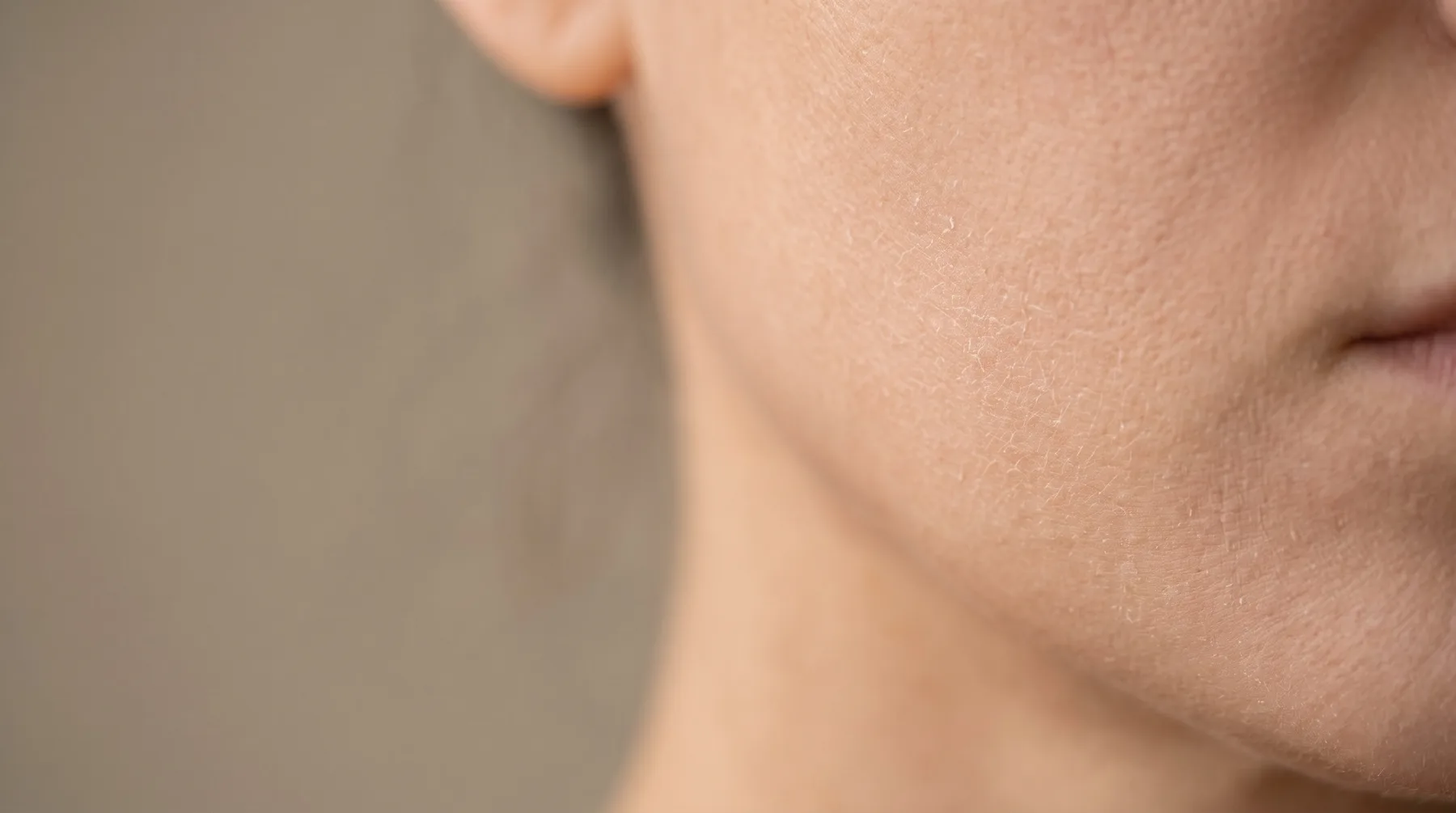 Dry, dehydrated skin, close up — PROVEN personalized skincare