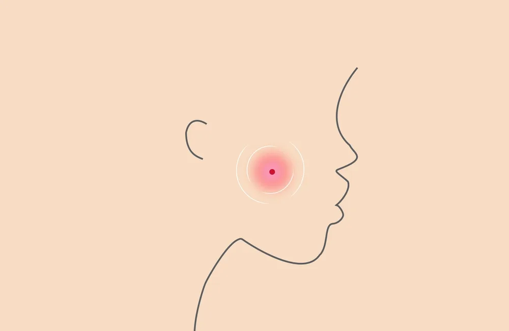 3 Food Types That Cause Acne to Avoid — PROVEN personalized skincare