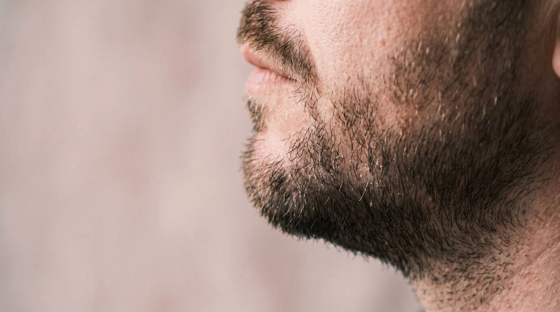 Beard dandruff — close-up of a bearded jaw