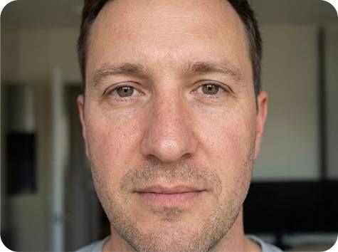Close‑up of a man's face with neutral expression, representing the need for personalized skincare assessment.