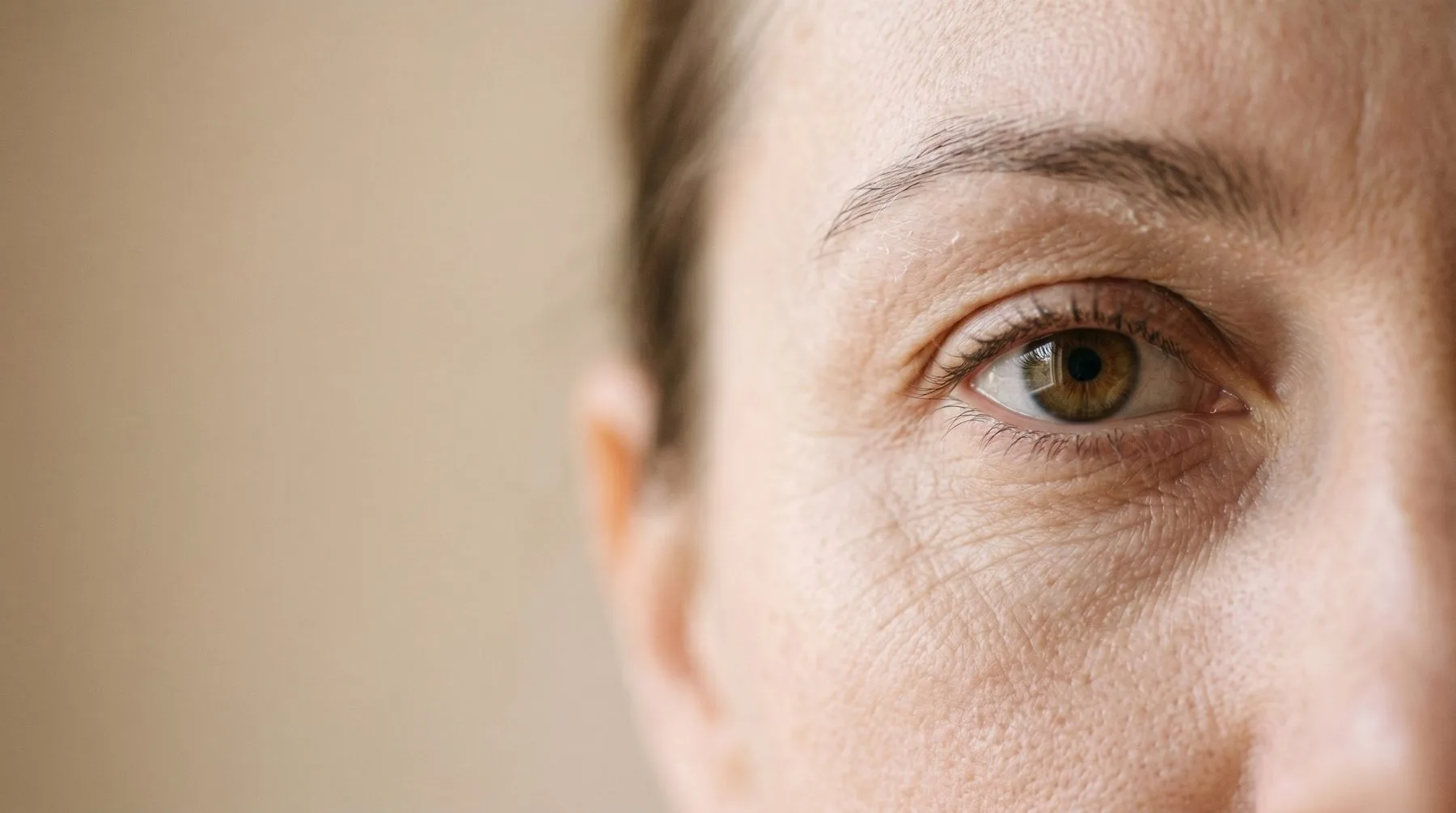 Dry skin around the eyes — eye-area close-up