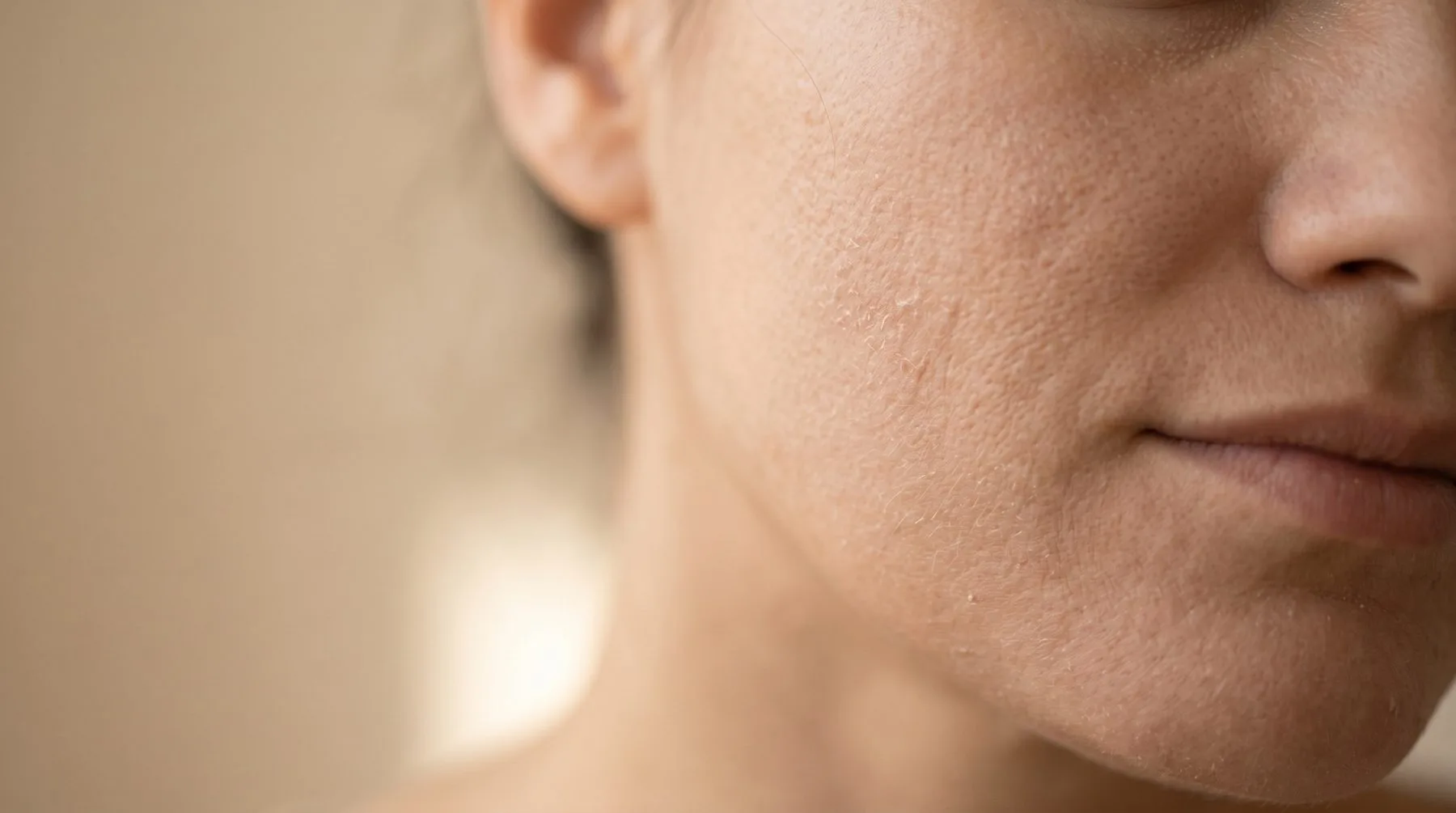 What causes dry skin — cheek close-up with dry, flaky texture