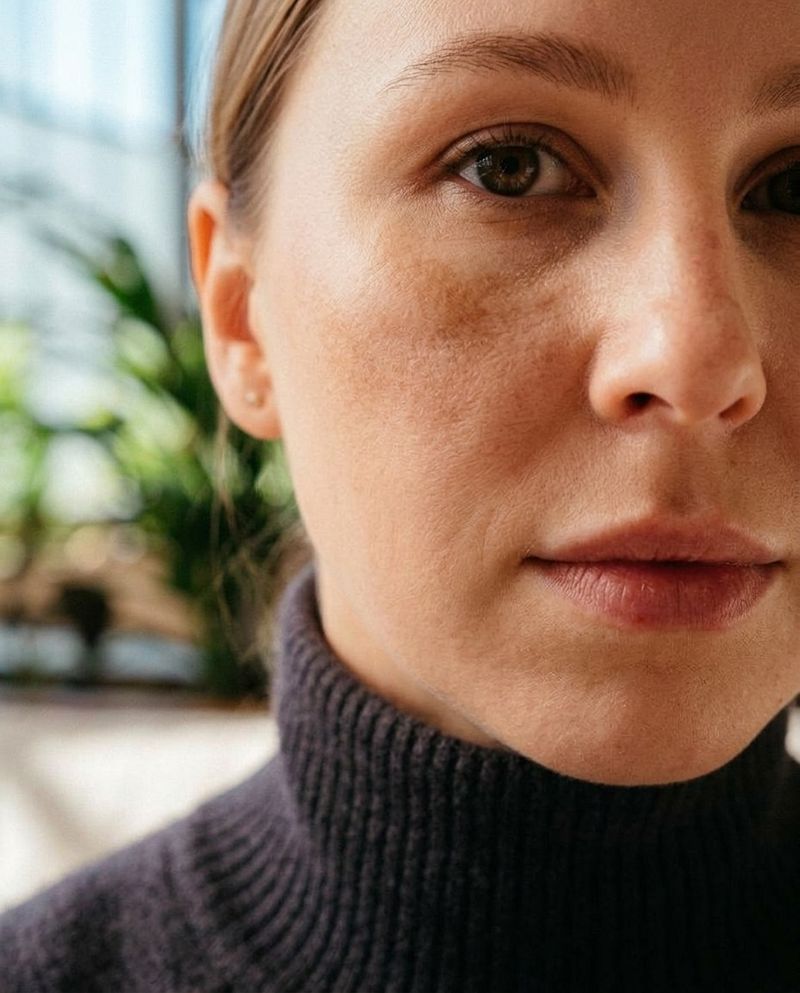 Editorial portrait showing skin with visible melasma, calm expression, honest skin texture