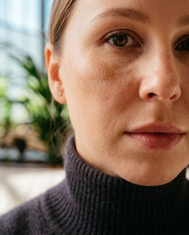 Editorial portrait showing skin with visible melasma, calm expression, honest skin texture