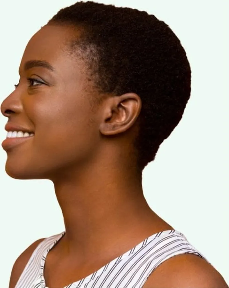 Skin Barrier: What is it and How to Protect It?