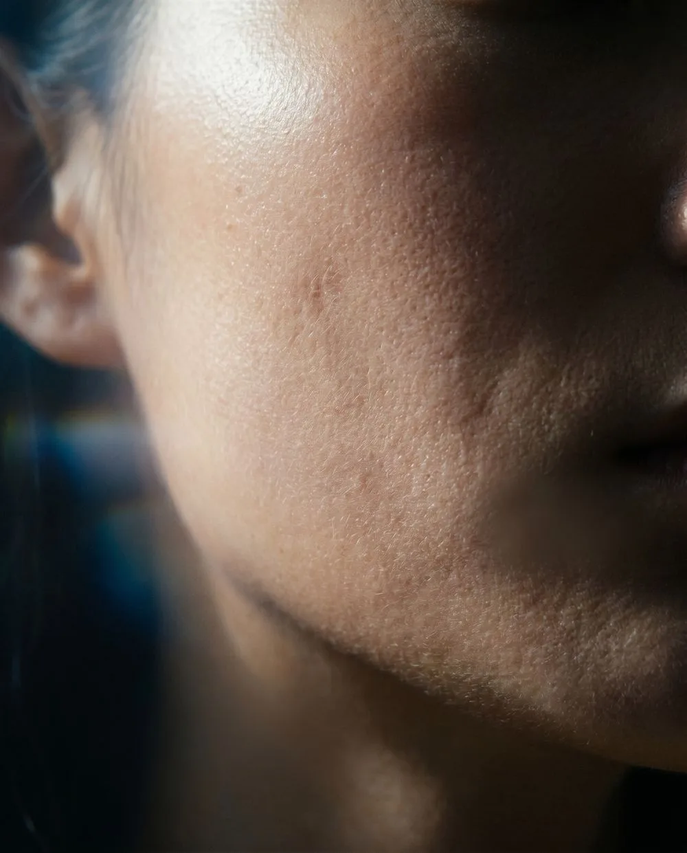 Activated Terrain macro of real skin — the algorithm's view of the surface it reads.