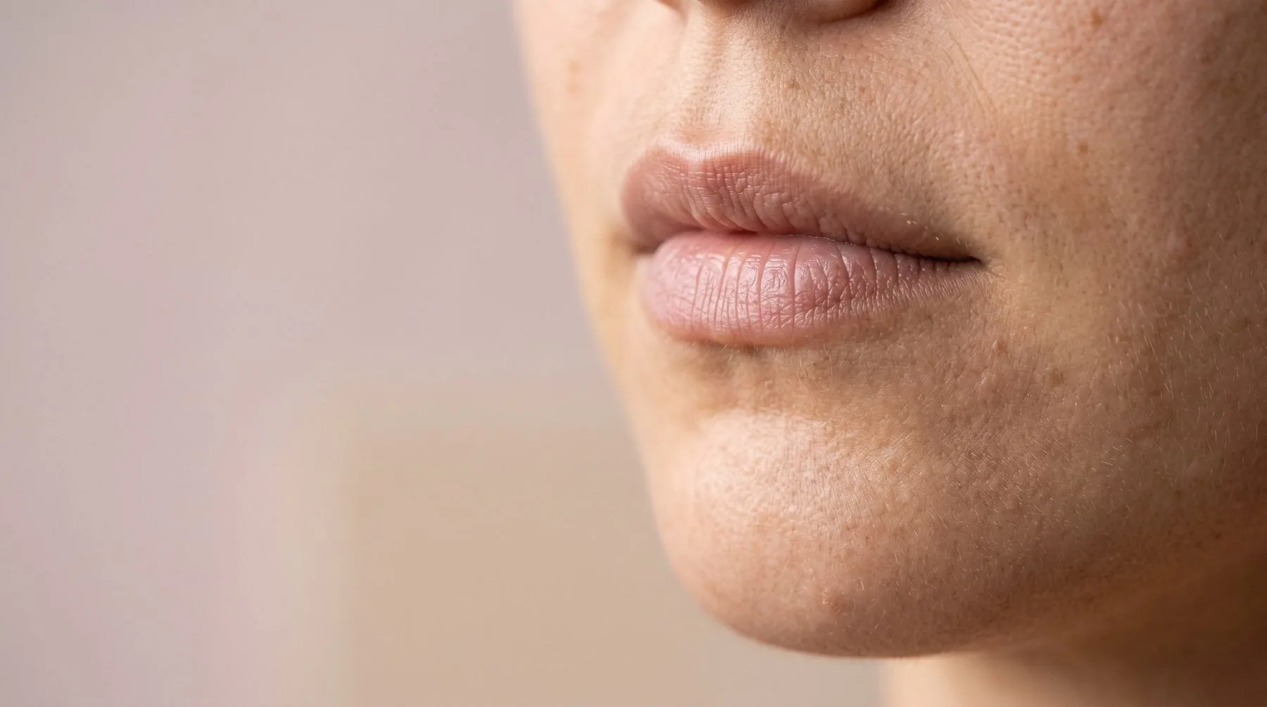 Dry skin around the mouth — lower-face close-up