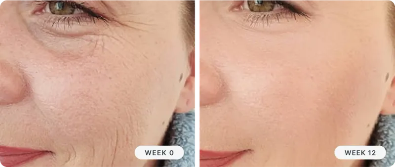 Granactive Retinoid vs. Retinol: What's the Difference?