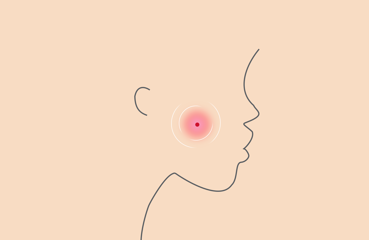 Image of Causes of Acne in Adults: The List of Reasons & Treatments