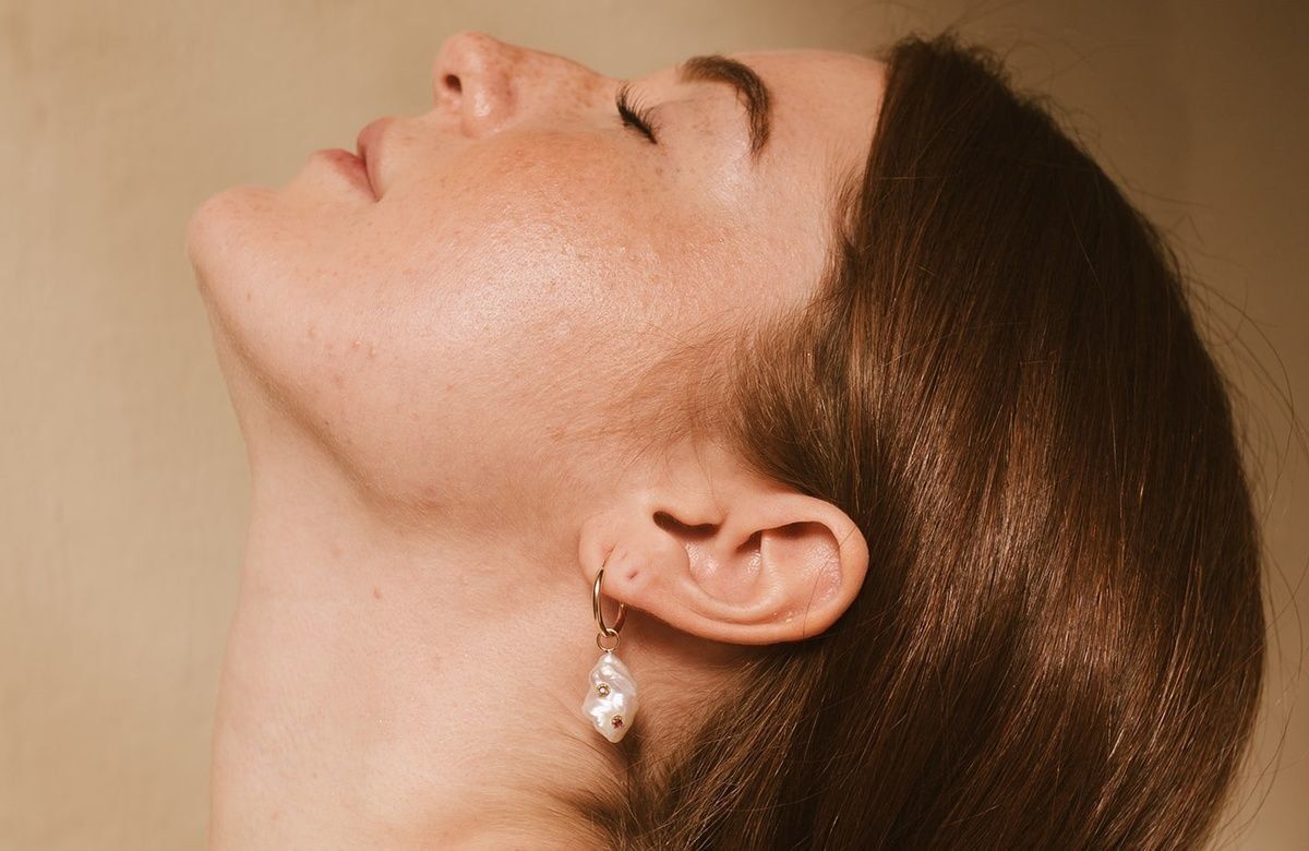 Image of How to Use Vitamin C for Dark Spots