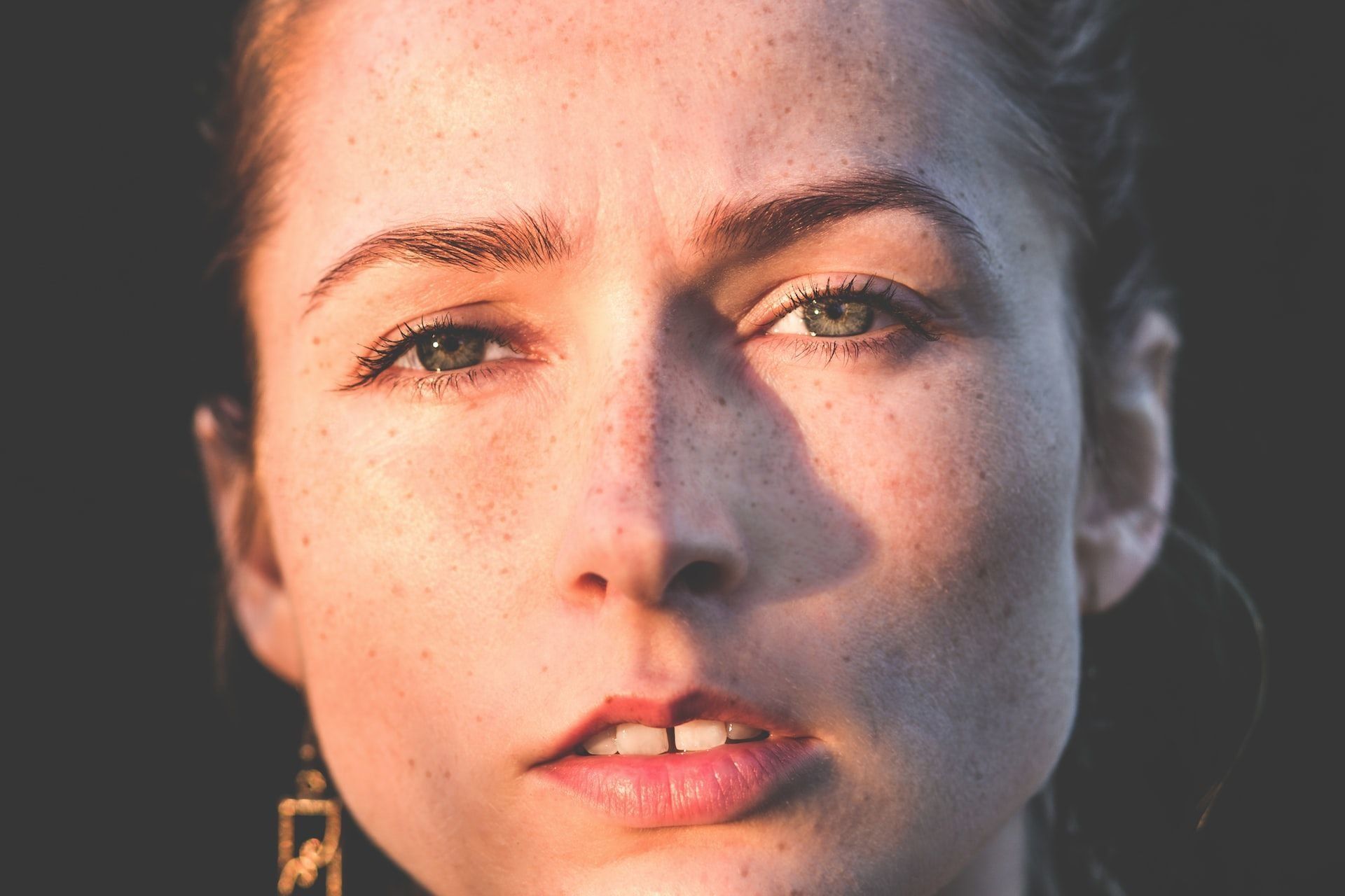 Image of How To Get Rid of Nose Acne In 4 Steps