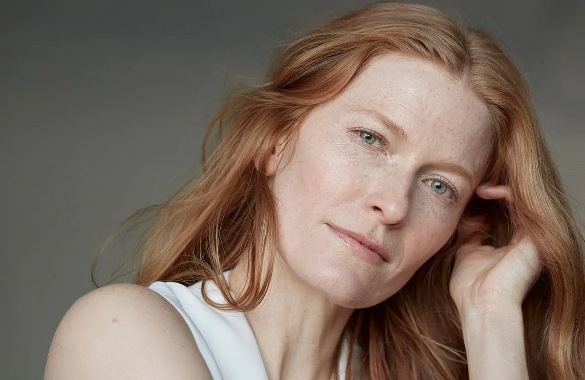 A Guide to Post-inflammatory Hyperpigmentation: Problematic, but Not Permanent.