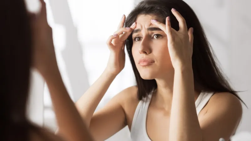 Heat Acne: What is it and How to Treat it