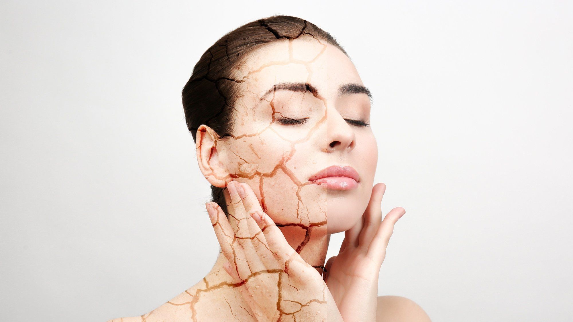 Image of Dehydrated Skin vs. Dry Skin: What’s the Difference?