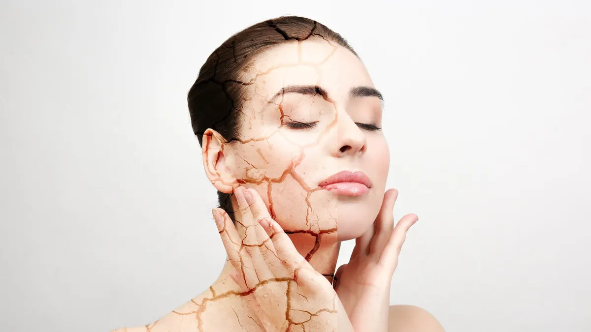 How to Fix Dry, Flaky Skin on Your Face
