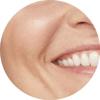 Fine Lines and Wrinkles