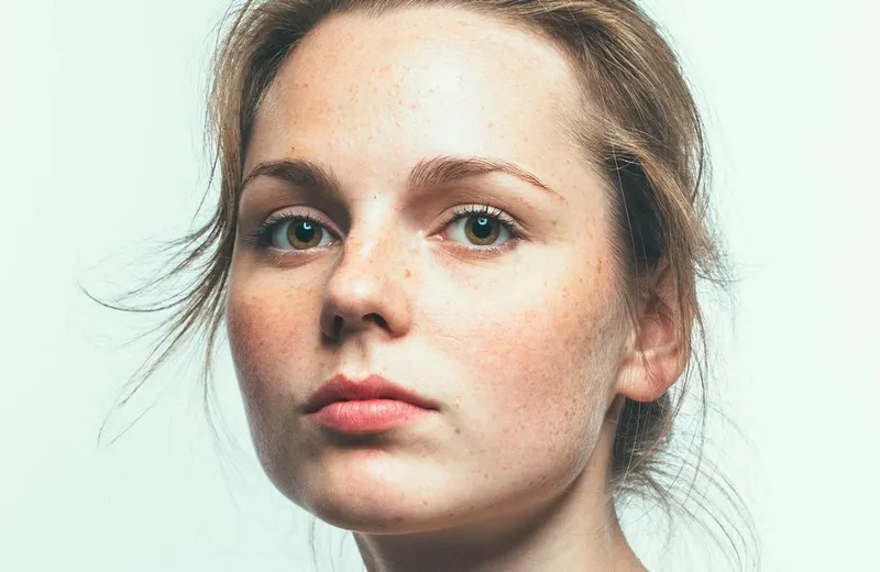 How To Cure Dry Skin On Your Face Overnight