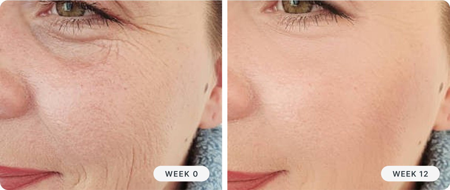 Granactive Retinoid vs. Retinol: What's the Difference?