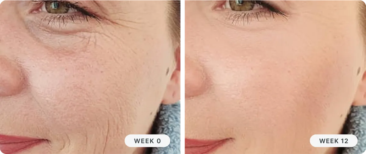 Granactive Retinoid vs. Retinol: What's the Difference?