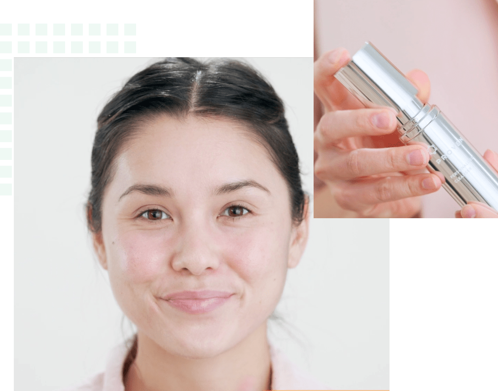 Image of Acne Face Map: What Your Breakouts Mean