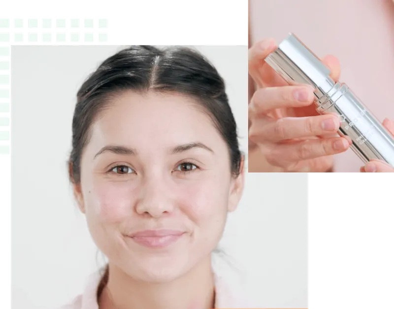 Acne Face Map: What Your Breakouts Mean