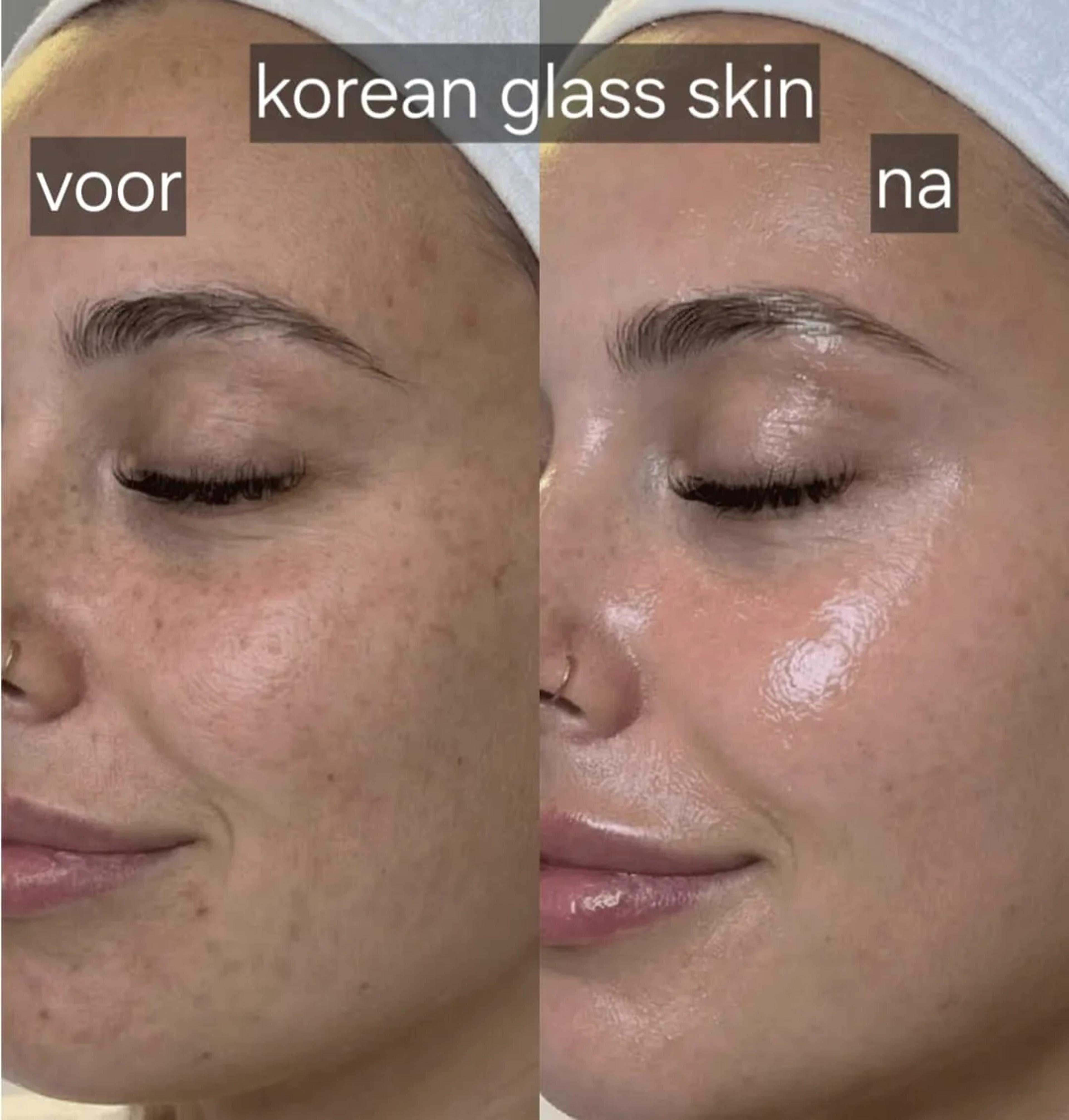 Korean glass skin: voor en na
