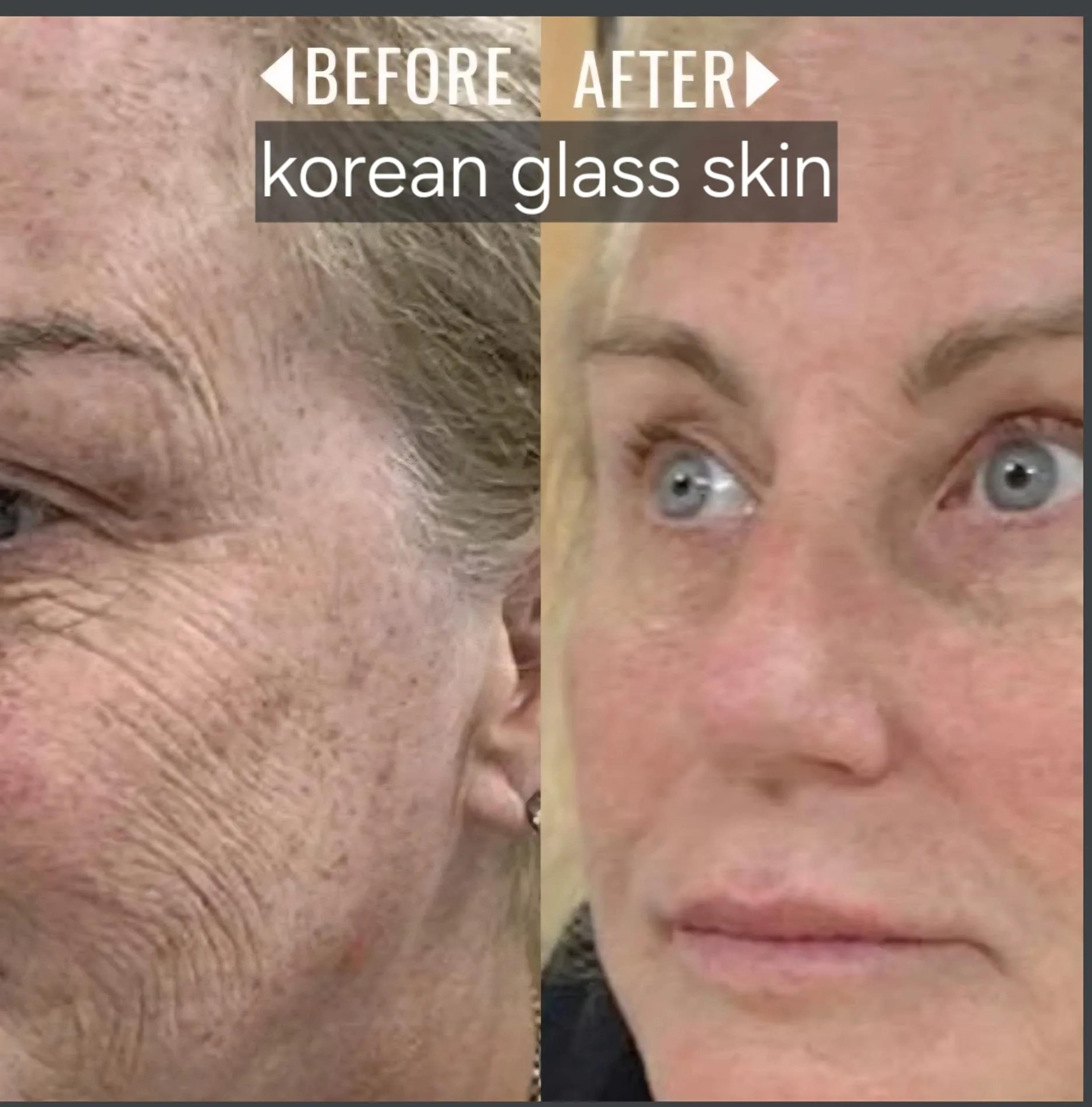 Korean glass skin: voor en na